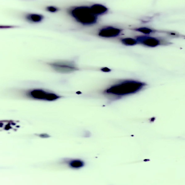 video frame